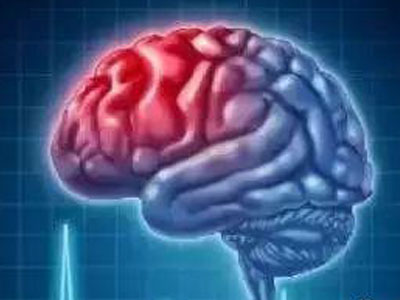 又到脑卒中高发季 你的颈动脉还好吗?