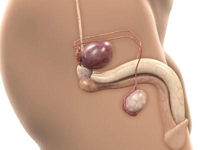 中年男性警惕输尿管结石!