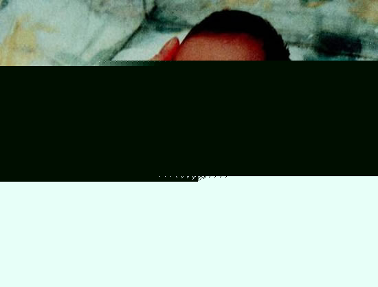 震惊全球的移植手术